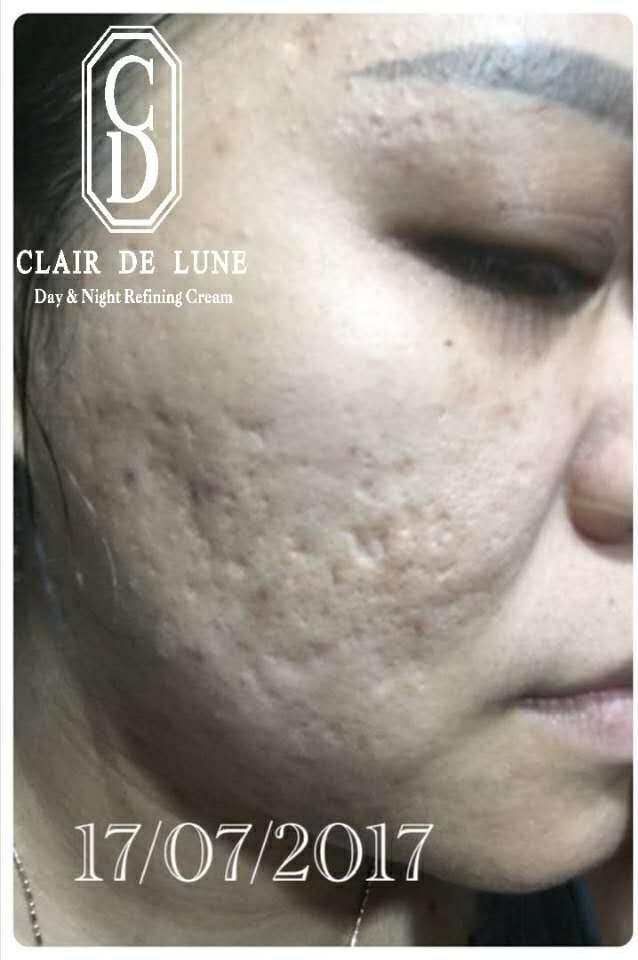 Buy Clair De Lune Cdl Day Night Cream Online Eromman